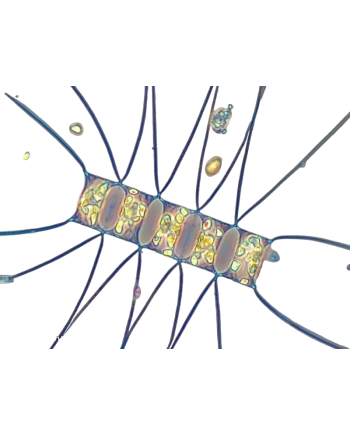 Chaetoceros aquaculturefrance
